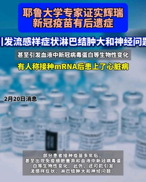 新冠疫苗（新冠疫苗后遗症的10个表现）
